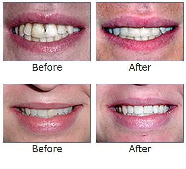 Maple Grove Family Dental Clinic