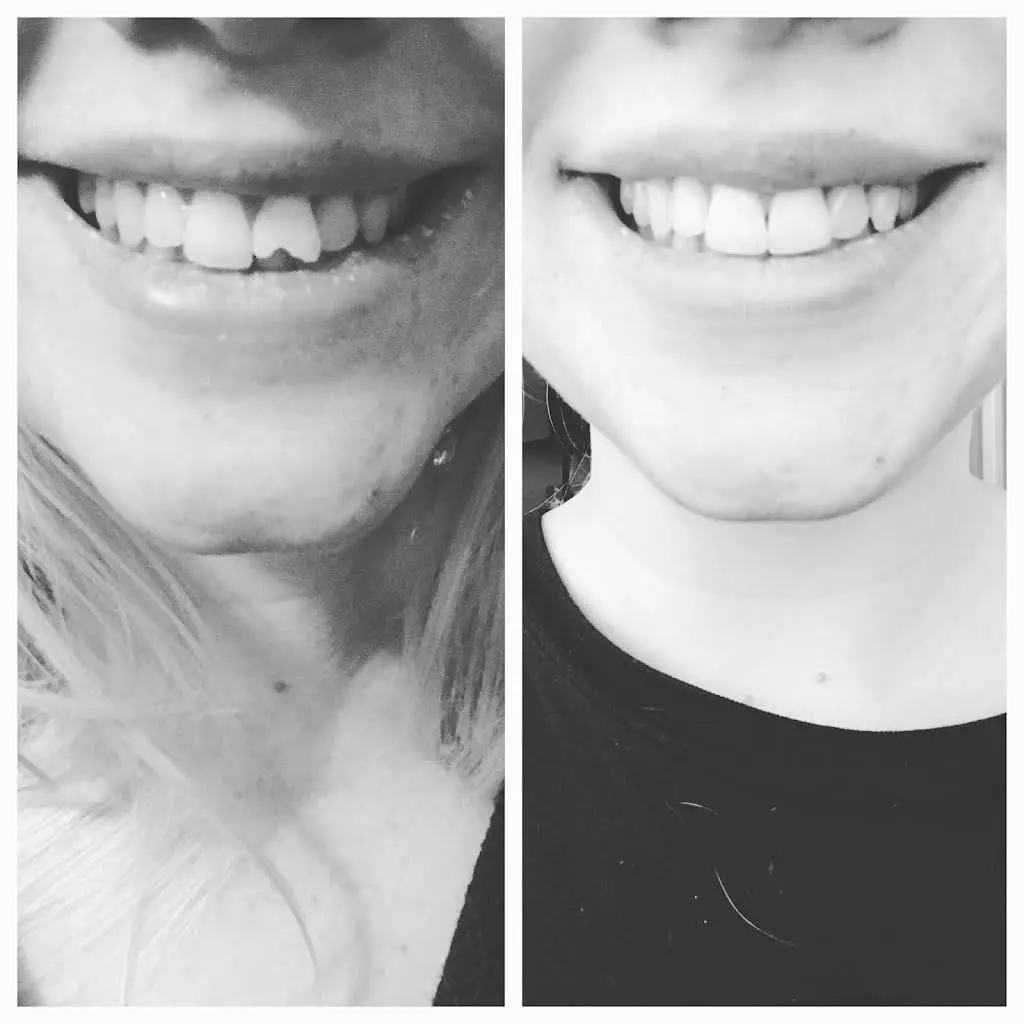 Mondale Dental