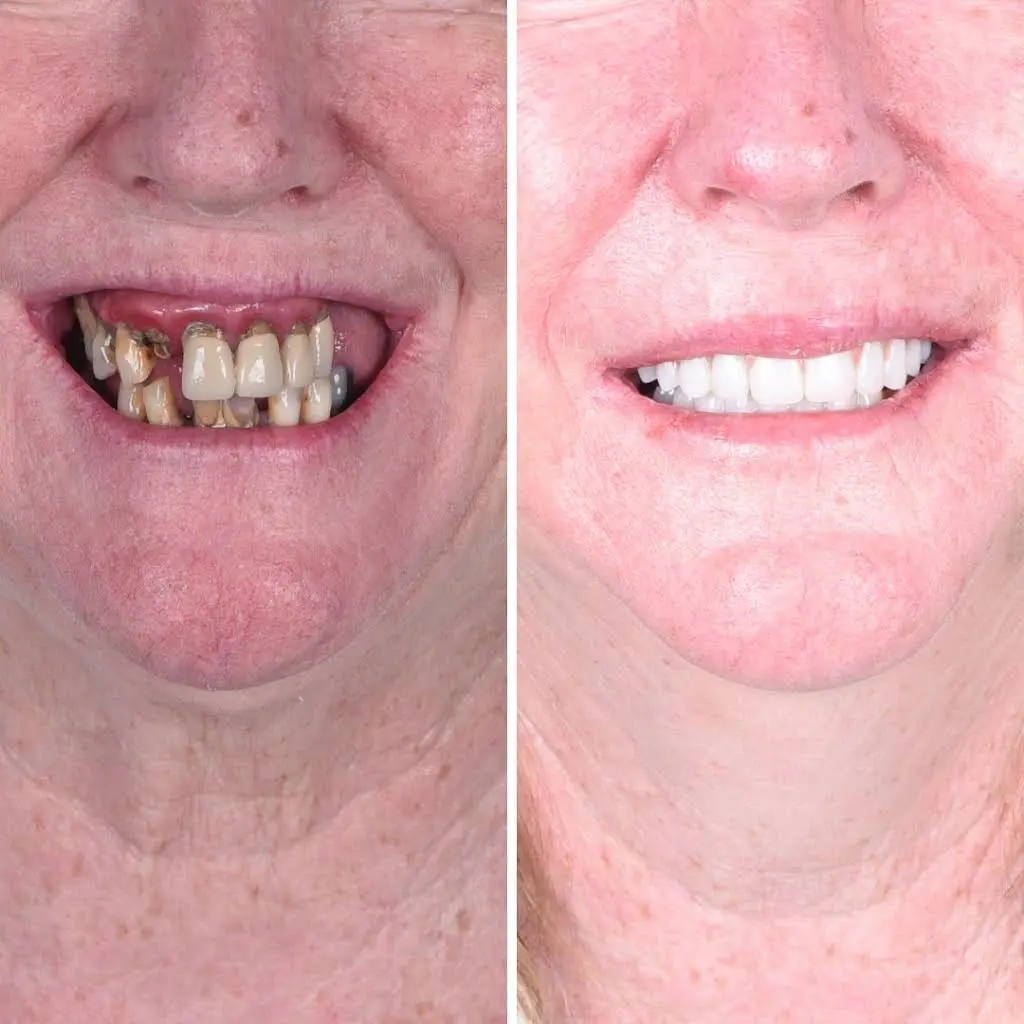 Britely Dentures + Implants Studio