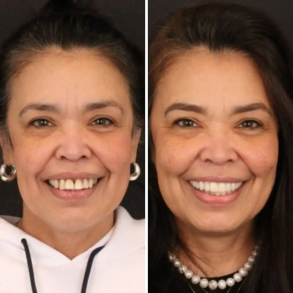 Britely Dentures + Implants Studio