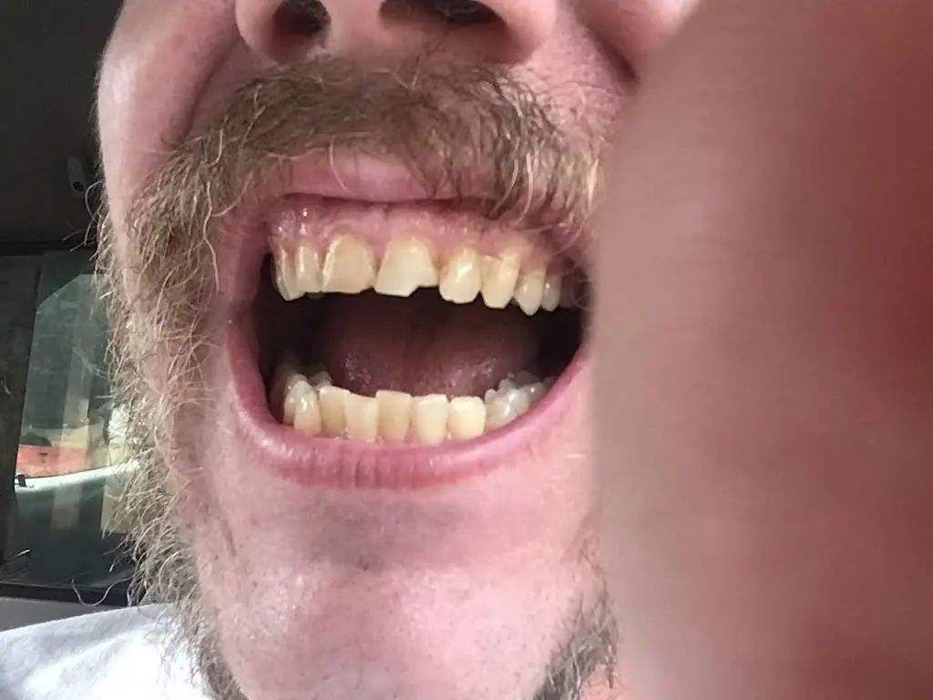 Gentle Dentistry