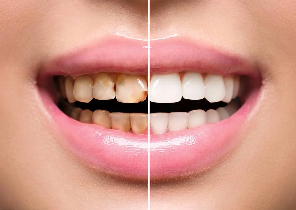 Ostrem Dental