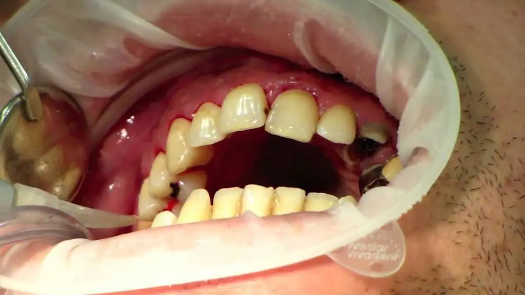 Ostrem Dental