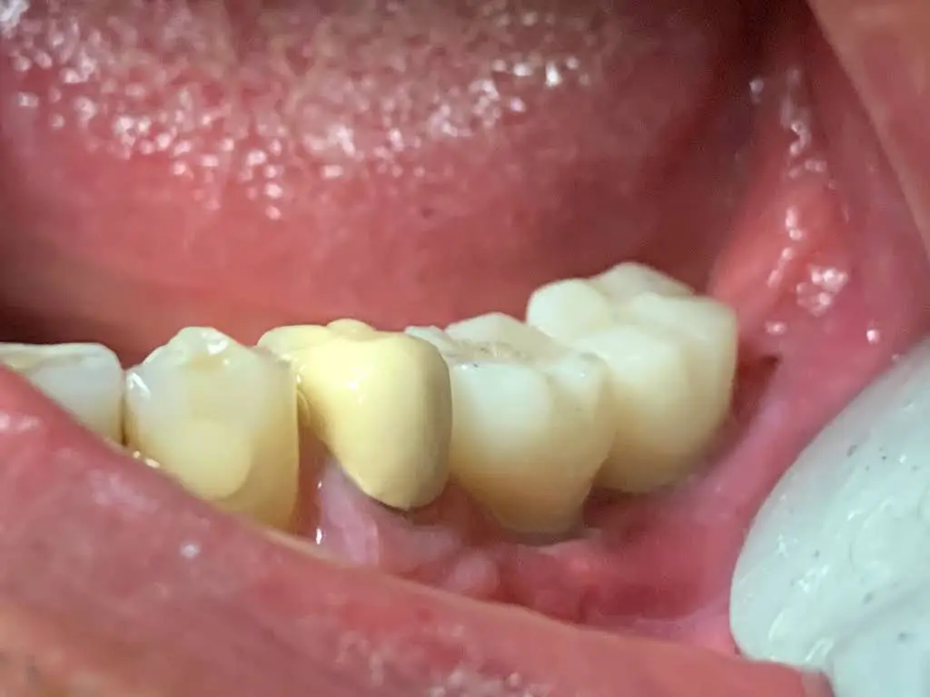 Almond Dental Maple Grove