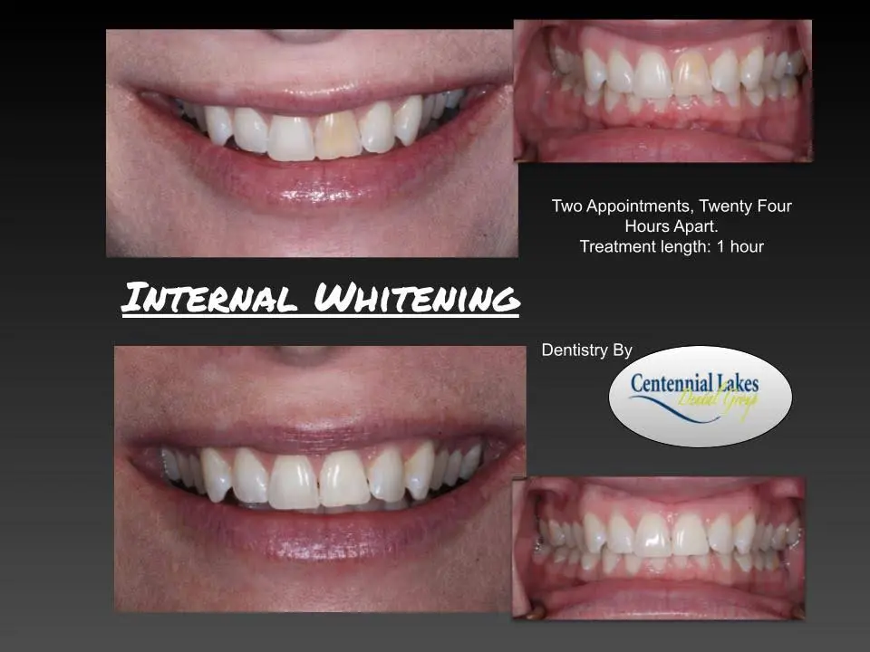 Centennial Lakes Dental Group