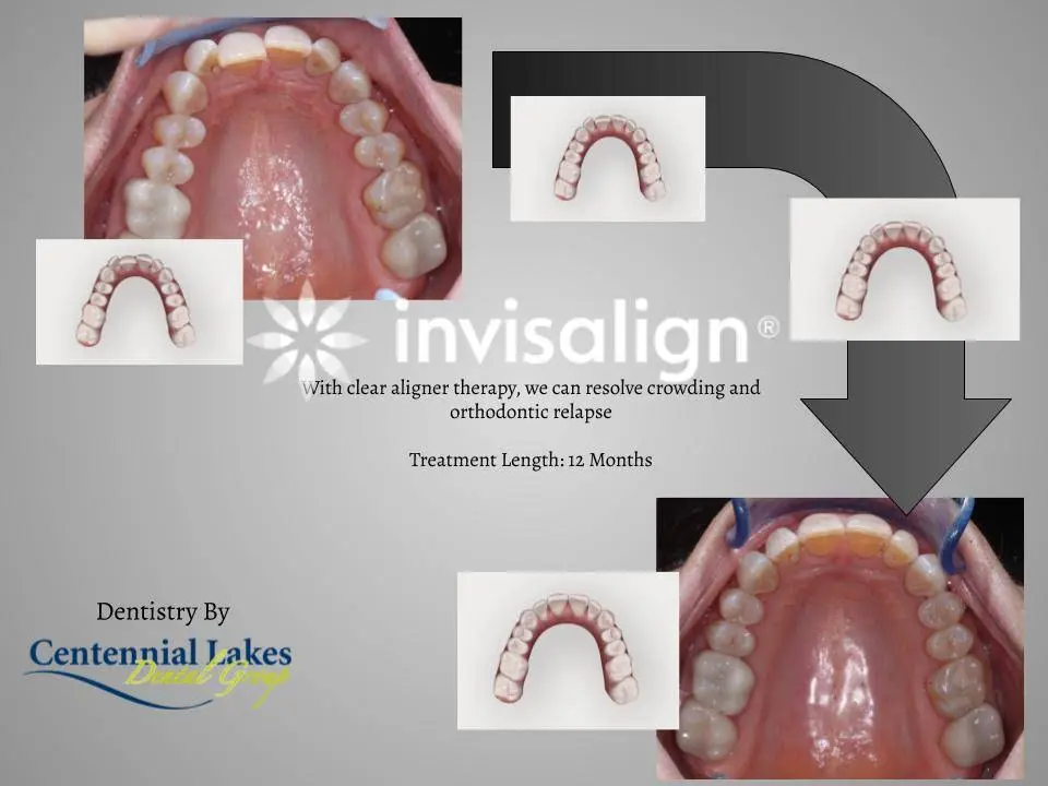 Centennial Lakes Dental Group