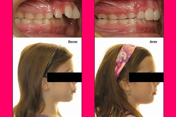 Pan Orthodontics - Edina