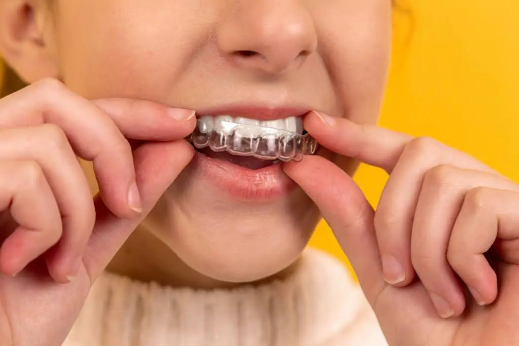 All Care Dentistry