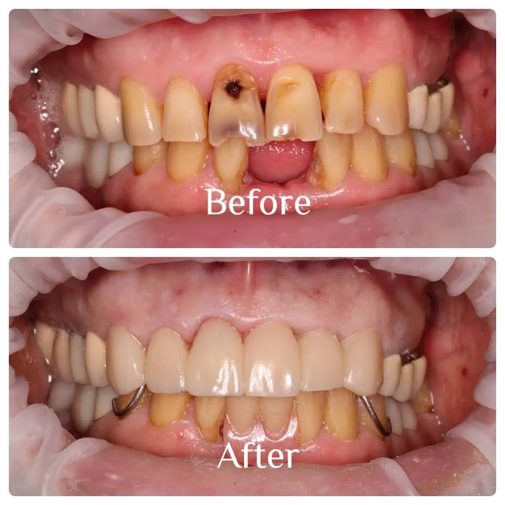 Ham Lake Dental