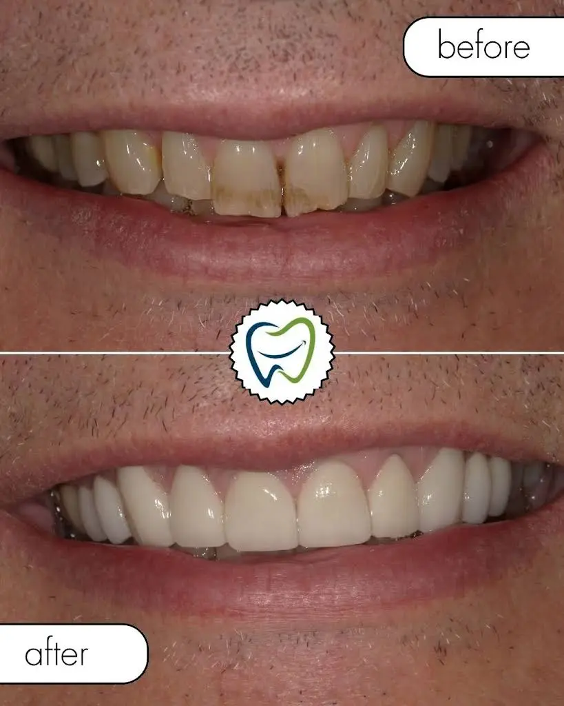Grand Avenue Smiles