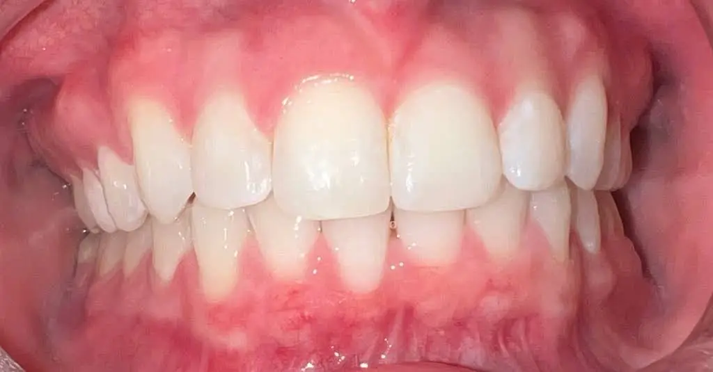 Pro Dental - Blaine, MN