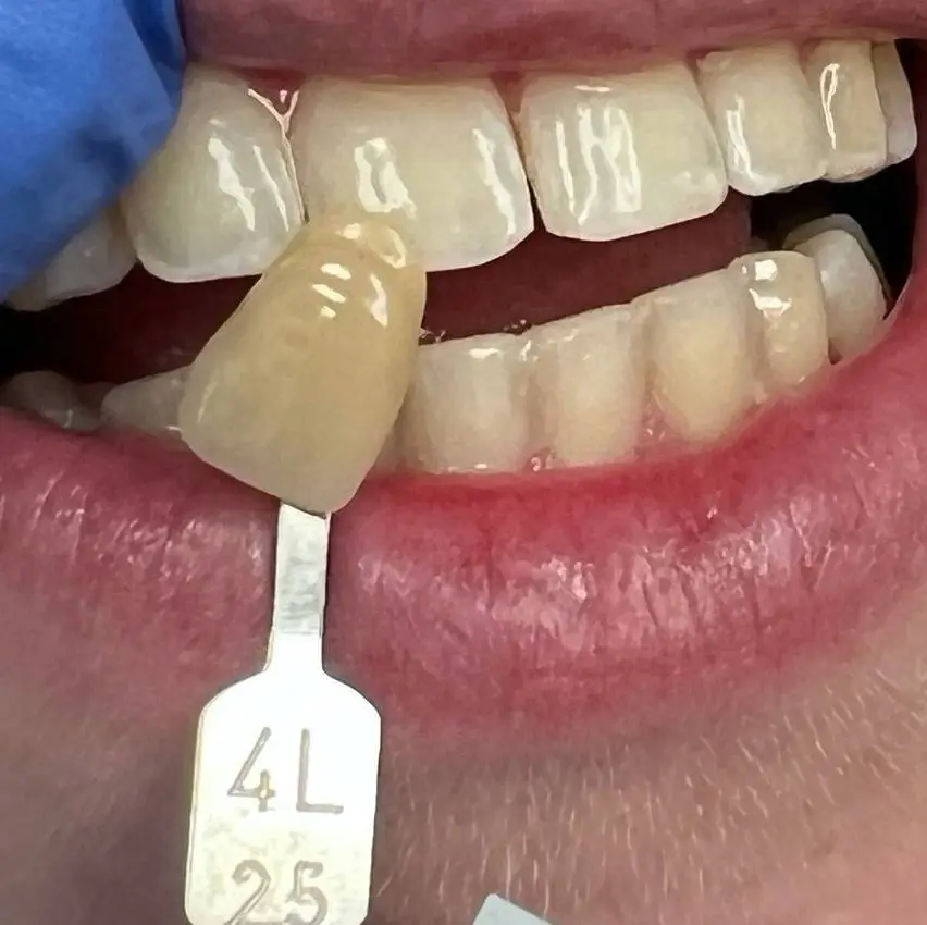 Pro Dental - Blaine, MN