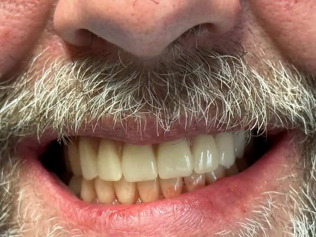 Almond Dental St. Anthony