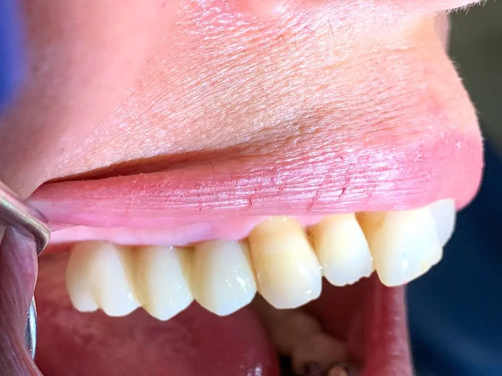 Almond Dental St. Anthony