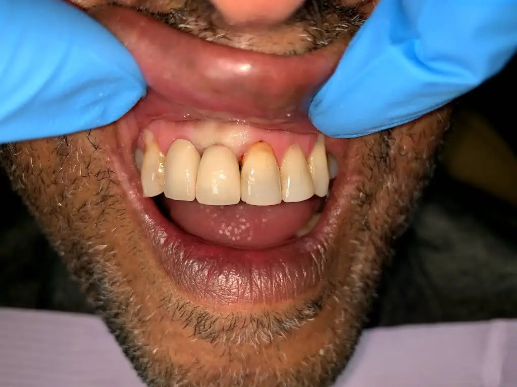 Almond Dental St. Anthony