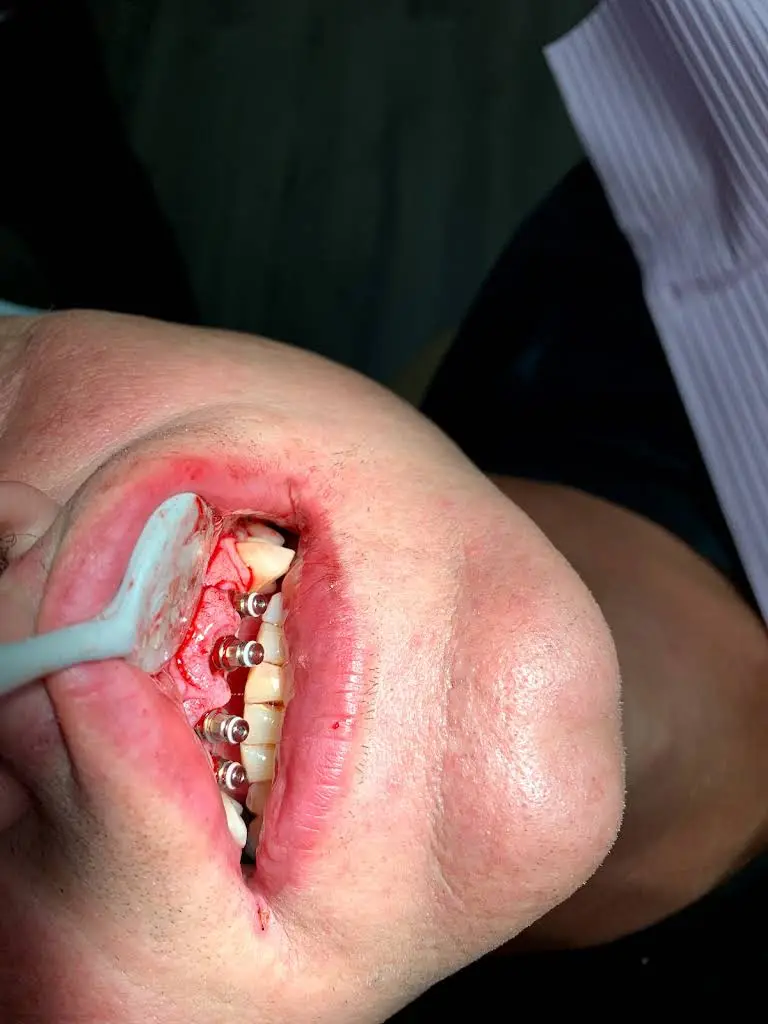 Almond Dental St. Anthony