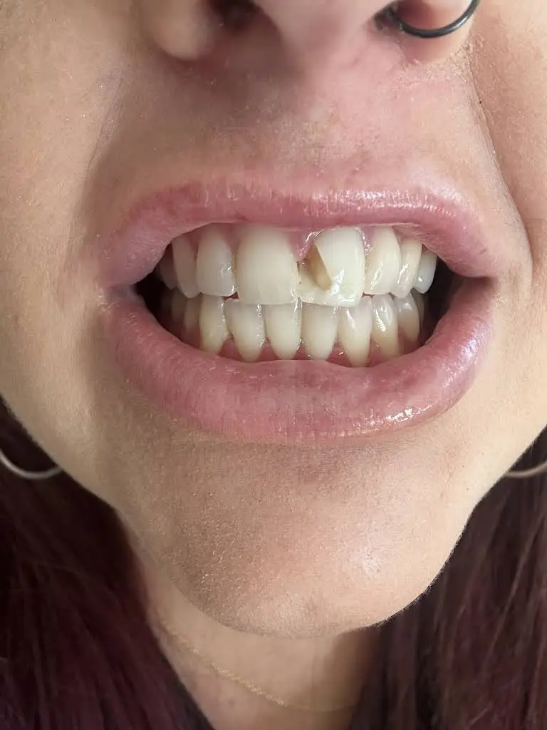 Aspen Dental