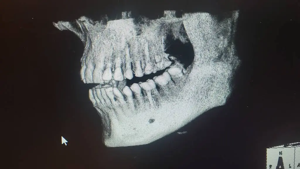 Emergency Dental Care USA