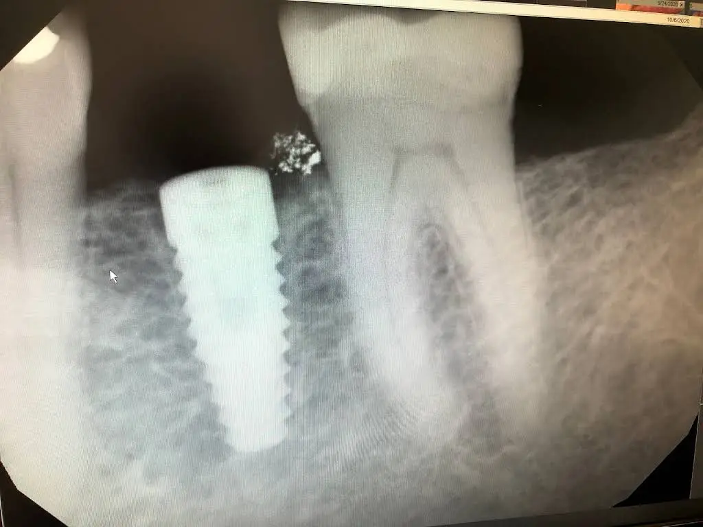 Pine Ridge Dental