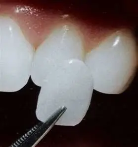 St Croix Valley Dentistry