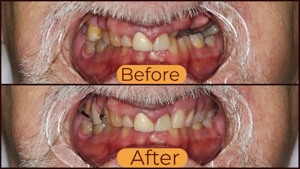 Natural Dental