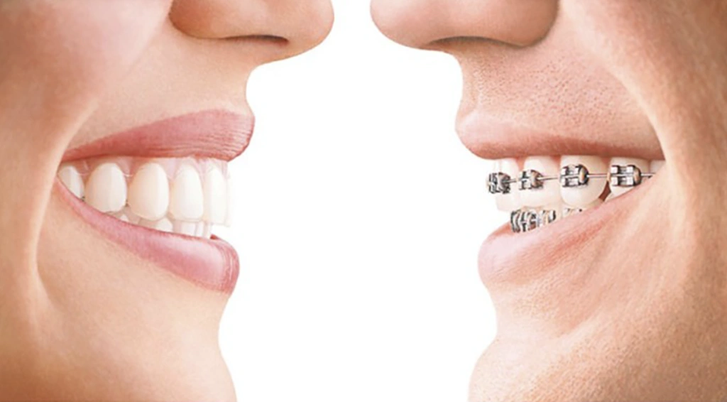 Orchin + Orchin Specialists in Orthodontics