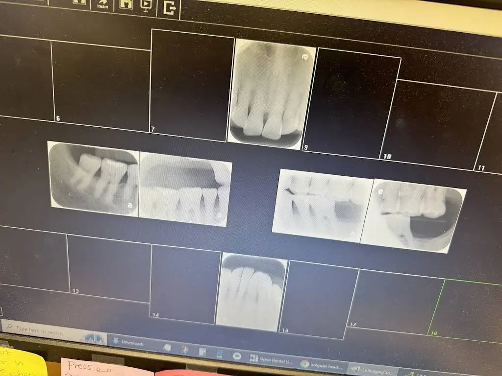 Smile Orthodontics Maplewood