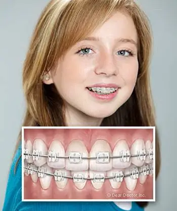 Carpenter Orthodontics - Fred W Carpenter DDS