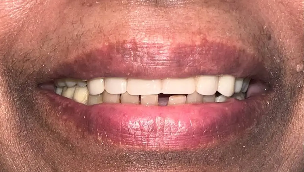 Elegant Dental Implant Center