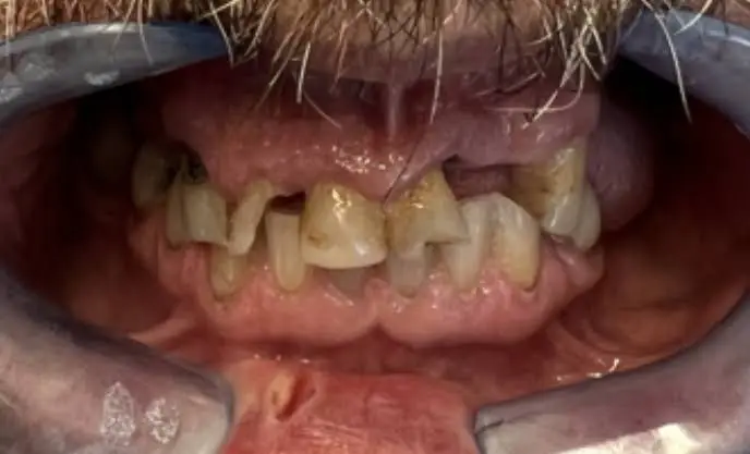Elegant Dental Implant Center