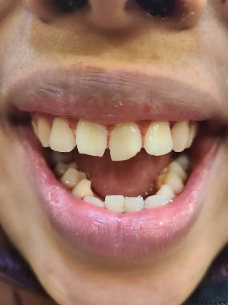 Smile Dental Care