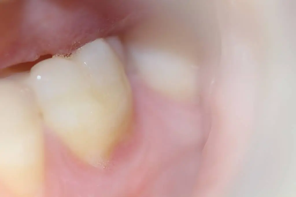 Leah Olson, DMD, Cosmetic and Family Dentistry