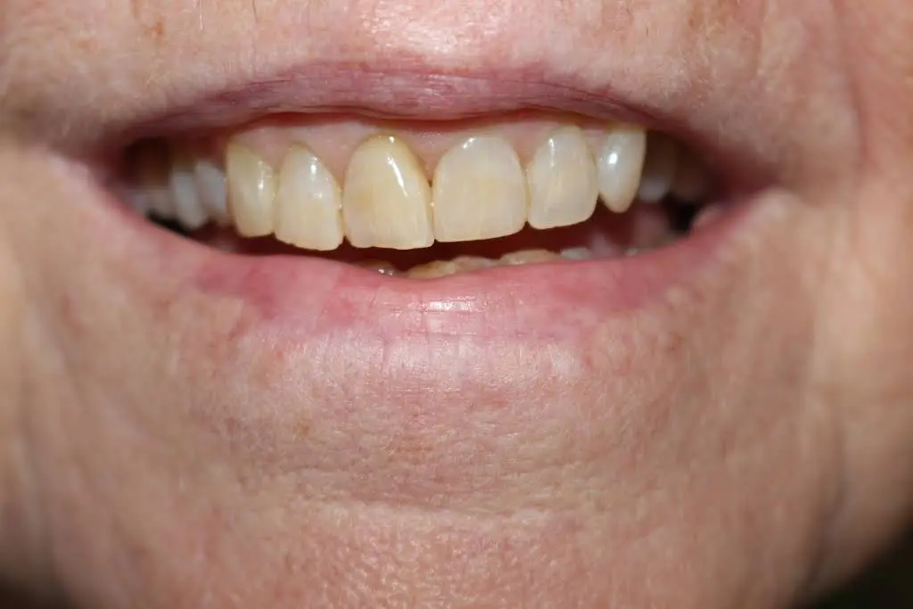 Leah Olson, DMD, Cosmetic and Family Dentistry