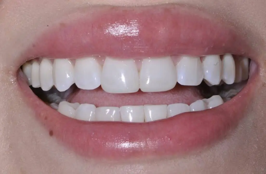 Opalesque Dentistry