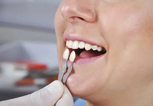 Walker & Krause Dental Team