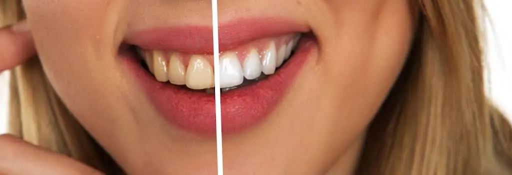 Safe Harbor Dental