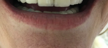 Family Dental Care - Dr. K Singh DDS