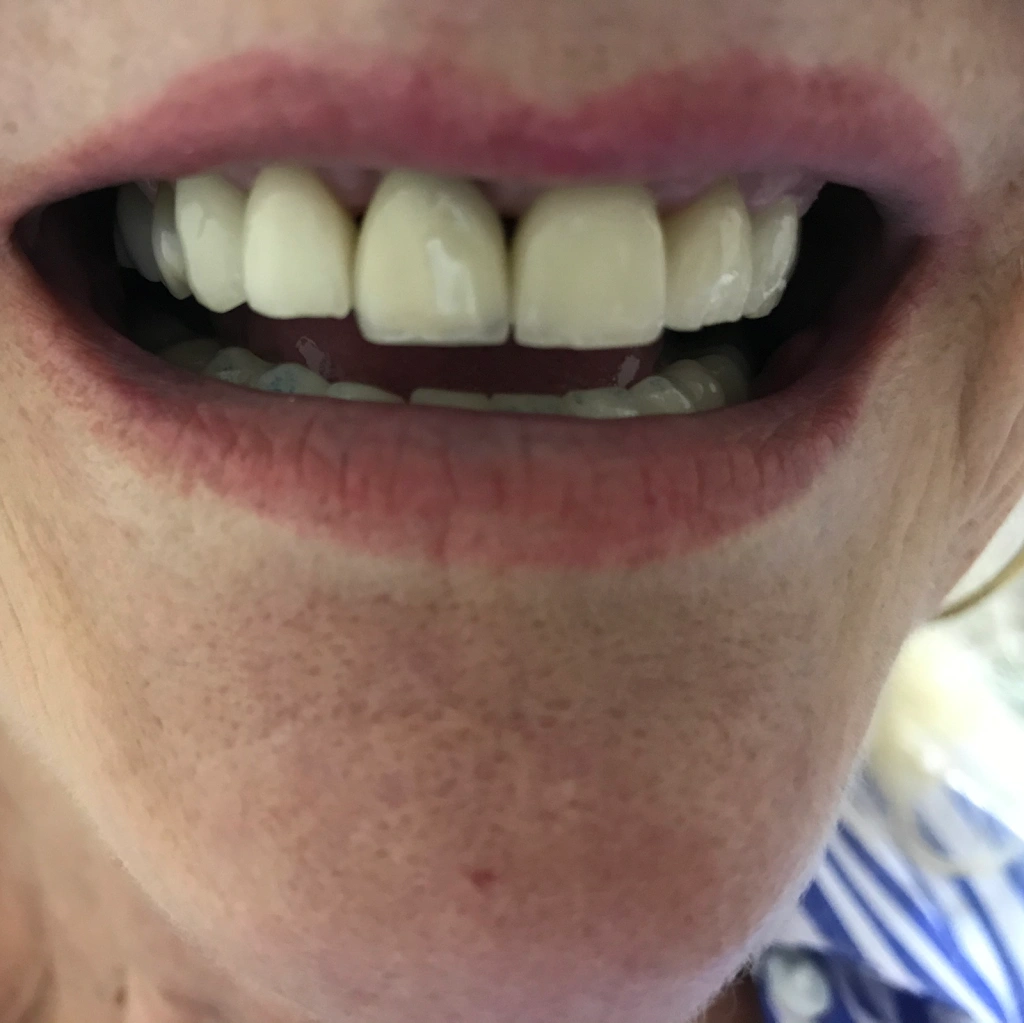 Family Dental Care - Dr. K Singh DDS