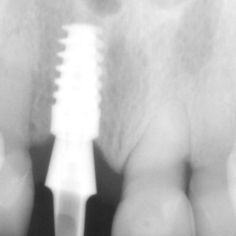 Family Dental Care - Dr. K Singh DDS