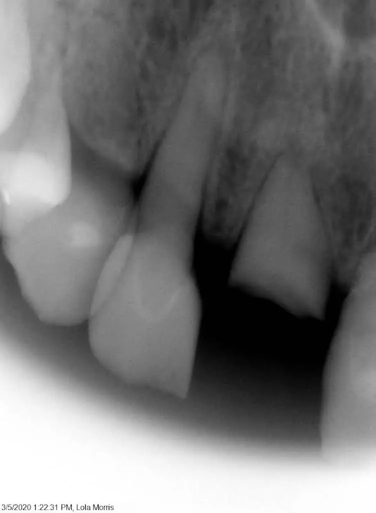 Family Dental Care - Dr. K Singh DDS