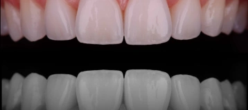 Spaulding Dental Co.