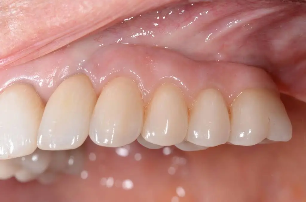 Spaulding Dental Co.