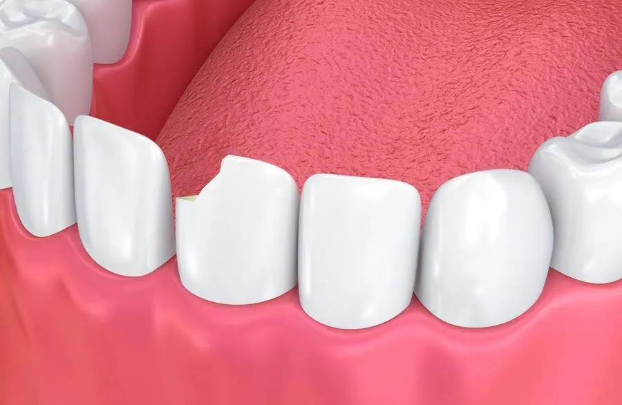 Sunrise Dental Gig Harbor
