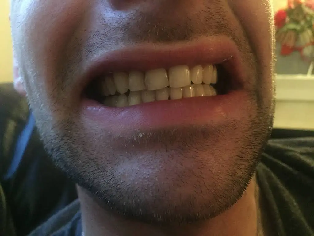 Sunrise Dental Gig Harbor
