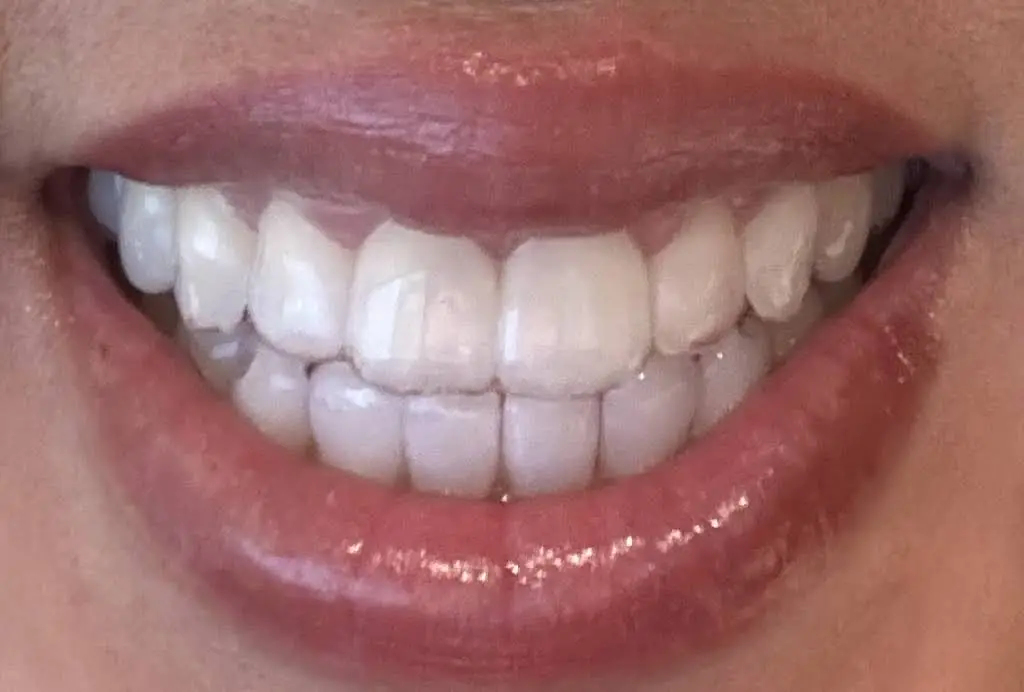 Snoqualmie Ridge Family Dental