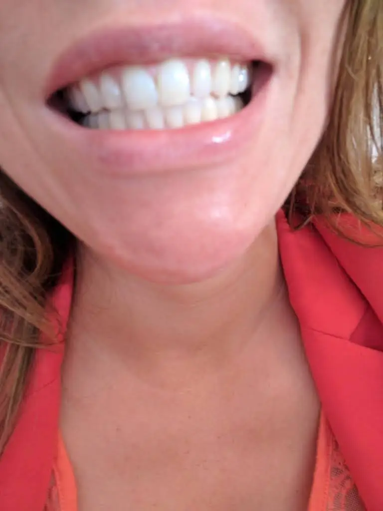 North Tacoma Dentist