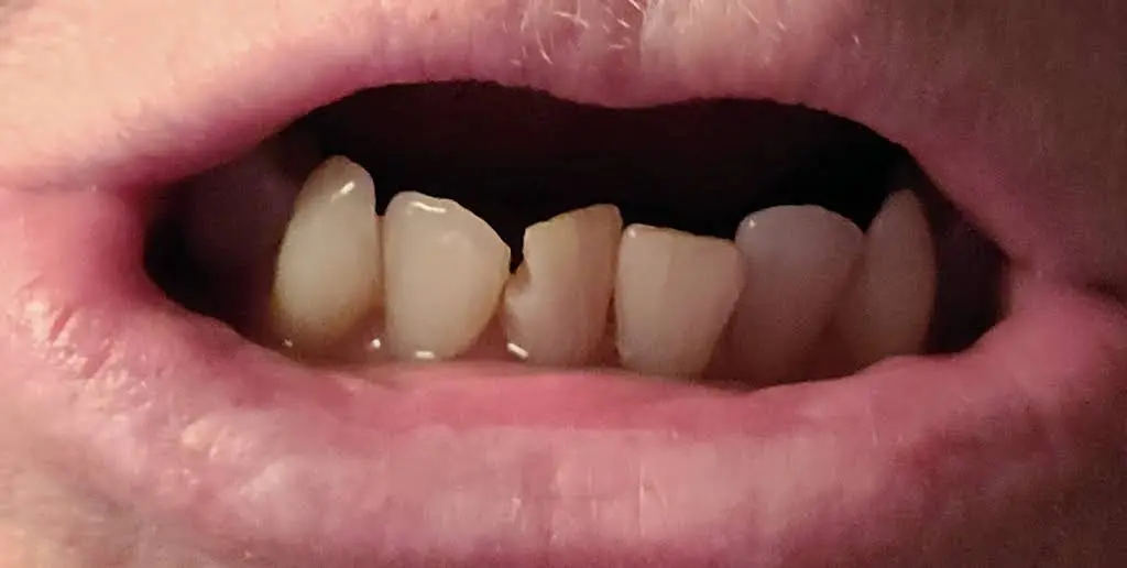 Plancich Dental