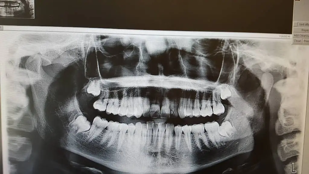 Bright Now! Dental & Orthodontics - Olympia, WA