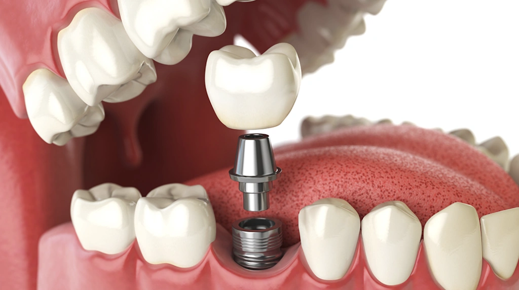 Olympia Oral and Maxillo-Facial Surgery: Dr. Kelson