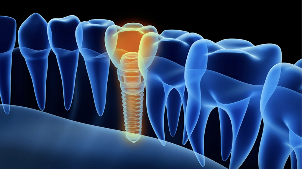 Olympia Oral and Maxillo-Facial Surgery: Dr. Kelson